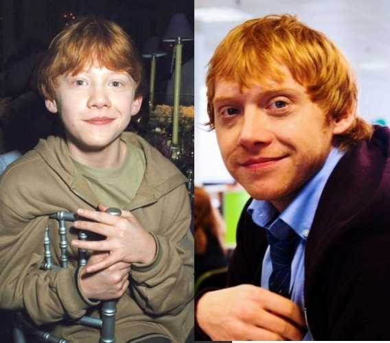 Rupert Grint na época das gravações da saga Harry Potter e em cartaz de divulgação da série Sick Note (Reprodução)