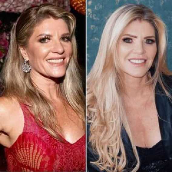 Antes e depois das cirurgias plásticas