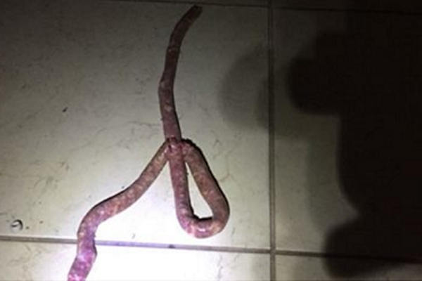 Cobra