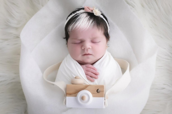 Com condição rara, bebê nasce de franja branca e internet vai à loucura