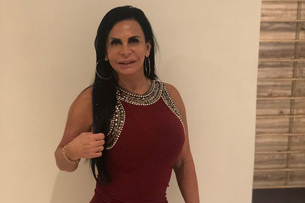 Gretchen faz preenchimento facial e mostra transformação na web