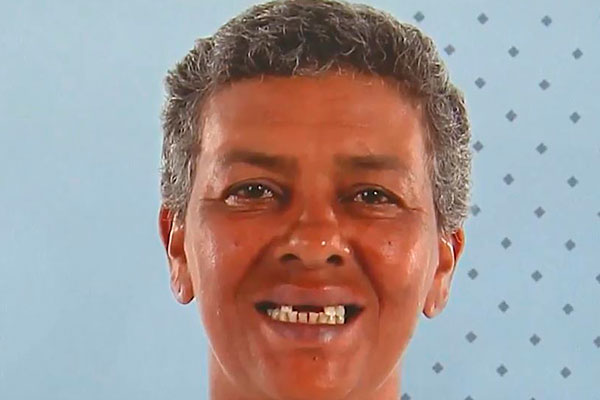 Participante passa por transformação IMPRESSIONANTE no Beleza Renovada
