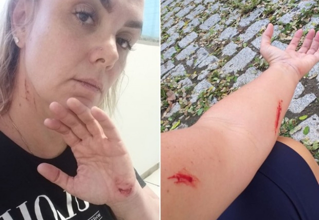 Reviravolta: imagens revelam ex-Paquita agredida se automutilando