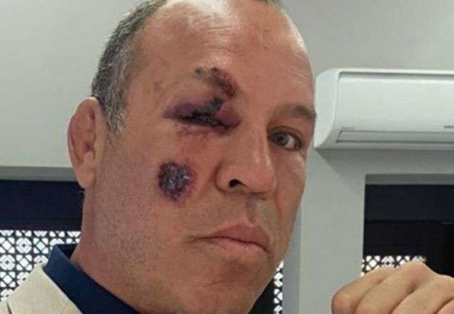 Atleta de MMA brasileiro é atropelado em Curitiba e faz apelo