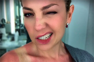 Thalia exagera no sol e mostra marca