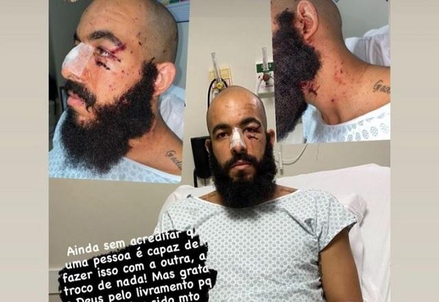 Danilo Fernandes machucado após ataque com bomba ao ônibus do Bahia
