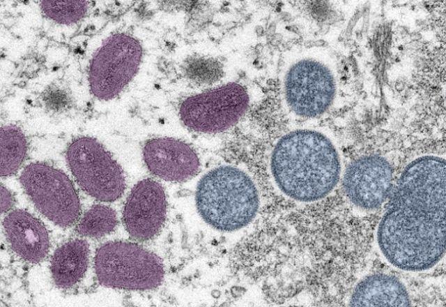 Ministério da Saúde confirma primeira morte por varíola dos macacos no Brasil | Reprodução
