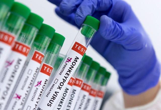 Previsão para o resultado do teste molecular é de até 72 horas após o recebimento da amostra | Reprodução/Agência Brasil