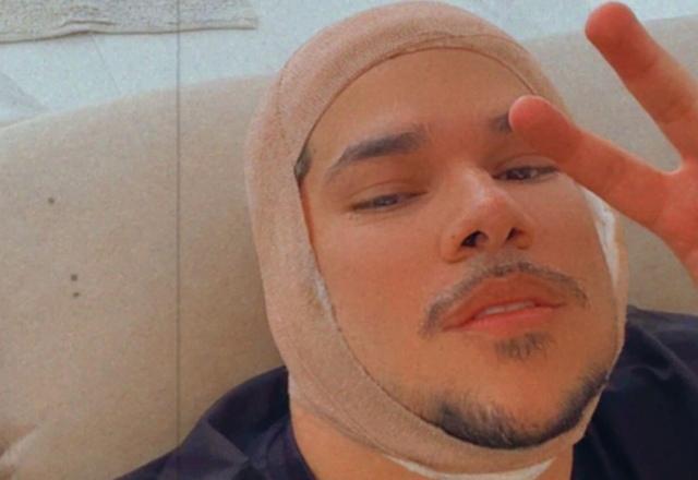 Imagem de Dj Buarque com a cabeça enfaixada por motivo de ter perdido parte da orelha em um acidente