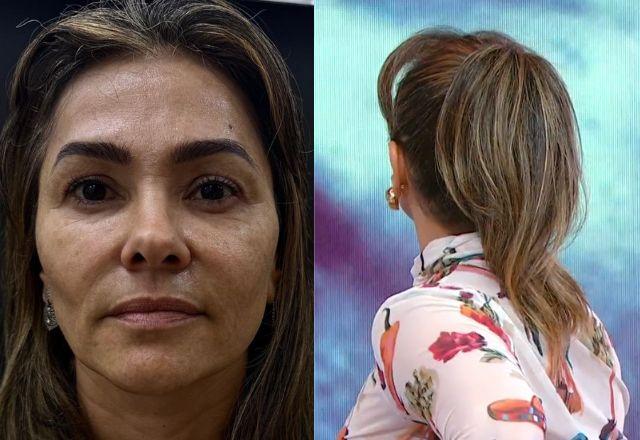 Suzana Alves antes da harmonização facial