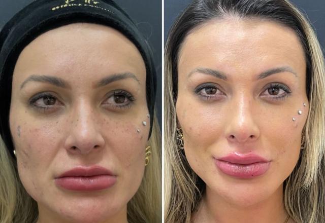 Andressa urach