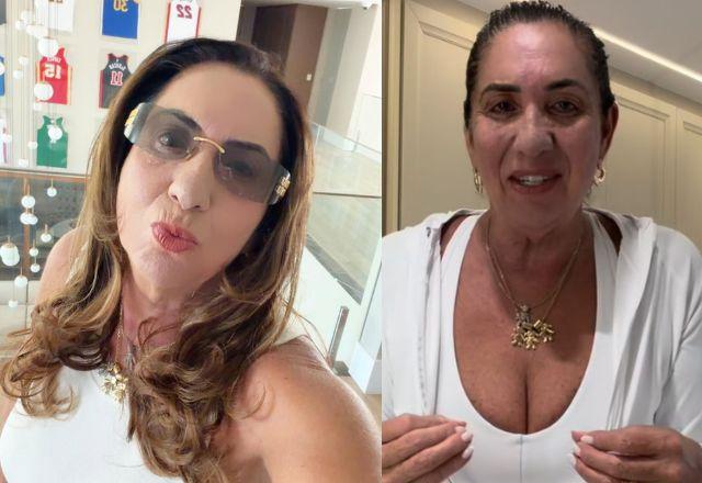 Margareth Serrão detalha recuperação após acidente e afirma: 'Agora tudo acabou'