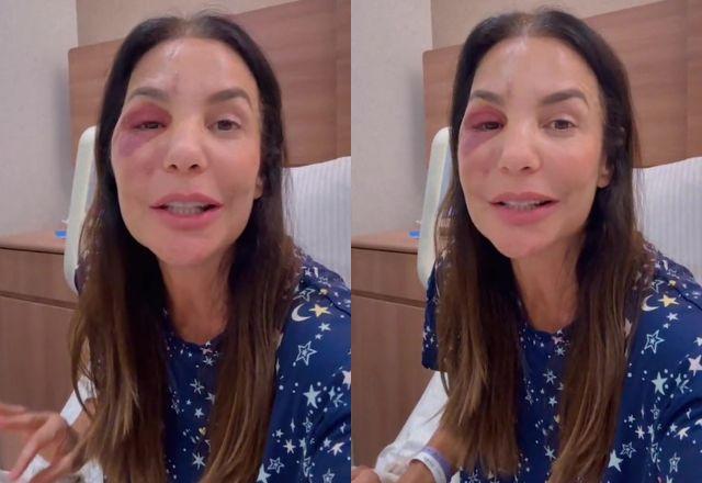 Daniel Cady atualiza saúde de Ivete após cirurgia e garante: 'Está bem'