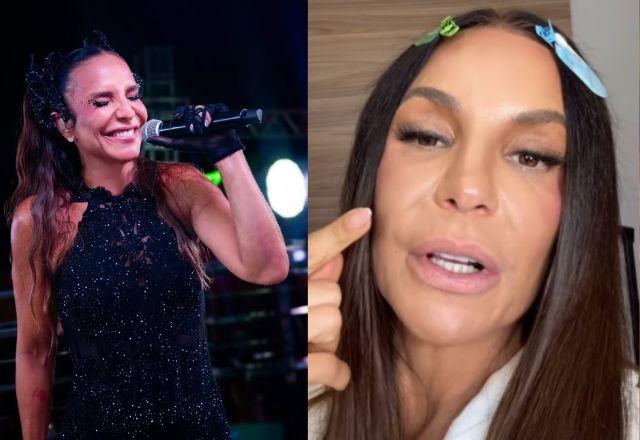 Ivete Sangalo reaparece após cirurgia no rosto e revela: 'Cheio de sangue pisado'