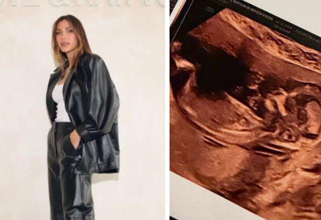 Nati Vozza posa para foto; do outro lado, foto de um ultrassom de bebê.