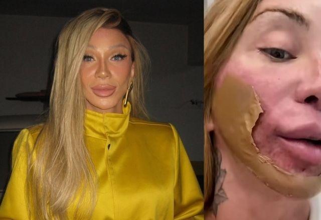 Maya Massafera revela procedimento intenso no rosto e explica busca por 'nova pele