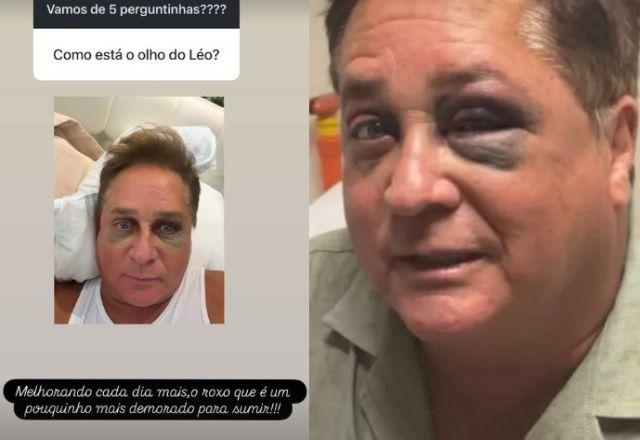 Leonardo em foto
