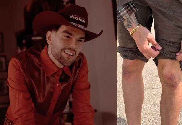 Imagem da notícia: Luan Pereira mostra joelhos machucados após pagar promessa em Fátima Imagem da notícia: Luan Pereira mostra joelhos machucados após pagar promessa em Fátima