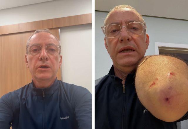 Imagem da notícia: José Roberto Burnier leva 4 pontos após ataque de pitbull Imagem da notícia: José Roberto Burnier leva 4 pontos após ataque de pitbull