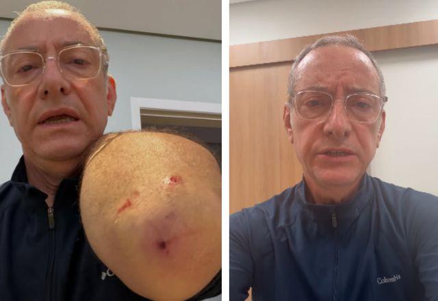 Imagem da notícia: Burnier desabafa sobre recuperação após ataque de pitbull Imagem da notícia: Burnier desabafa sobre recuperação após ataque de pitbull