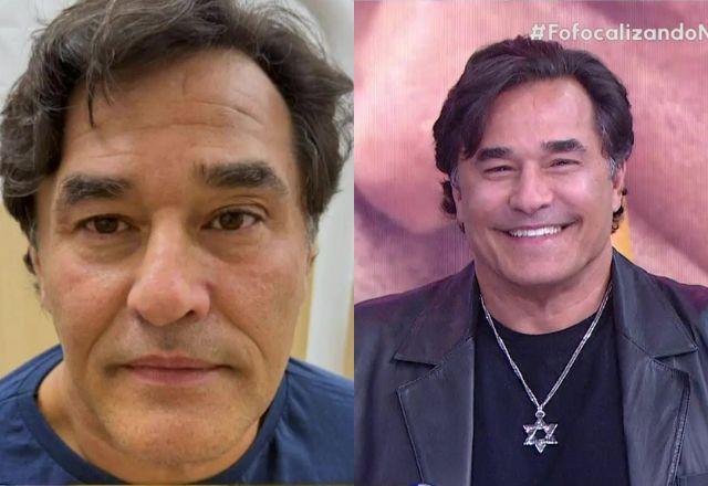 Imagem da notícia: Luciano Szafir vence receio e faz harmonização facial Imagem da notícia: Luciano Szafir vence receio e faz harmonização facial