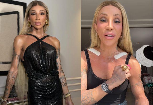 Imagem da notícia: "Quero ser feliz": Maya Massafera abre o coração após cirurgia Imagem da notícia: "Quero ser feliz": Maya Massafera abre o coração após cirurgia