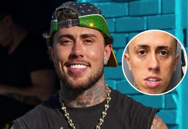 Imagem da notícia: MC Daniel mostra antes e depois de procedimentos Imagem da notícia: MC Daniel mostra antes e depois de procedimentos