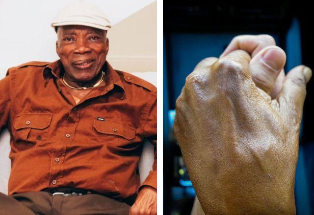 Imagem da notícia: Milton Nascimento recebe alta após tratar pneumonia Imagem da notícia: Milton Nascimento recebe alta após tratar pneumonia