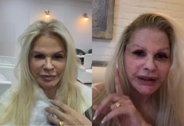 Imagem da notícia: Monique Evans mostra rosto após mini lifting facial Imagem da notícia: Monique Evans mostra rosto após mini lifting facial