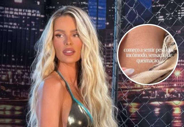 Imagem da notícia: Yasmin Brunet mostra marcas do lipedema e fala sobre sintomas Imagem da notícia: Yasmin Brunet mostra marcas do lipedema e fala sobre sintomas