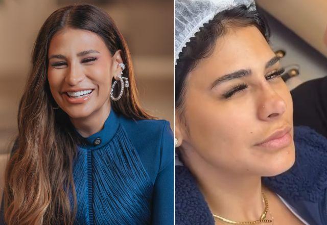 Imagem da notícia: Antes e depois de nariz de Simone Mendes chama atenção Imagem da notícia: Antes e depois de nariz de Simone Mendes chama atenção