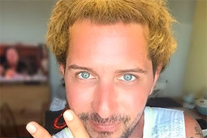Corajoso, Arlindo Grund pinta o cabelo de amarelo para bloquinho