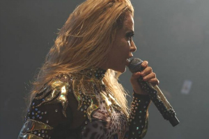 Joelma aparece com rosto vermelho e inchado após tratamento