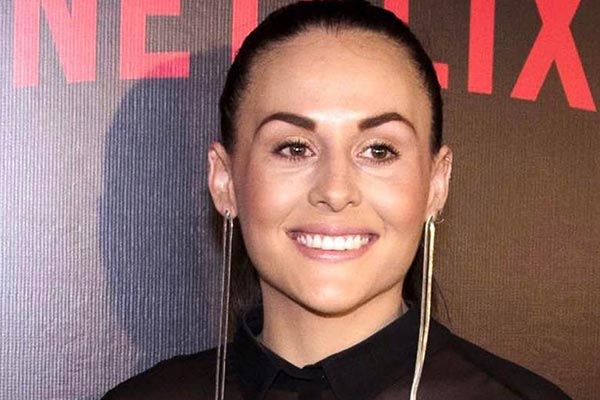 Fãs ficam chocados ao ver nova aparência de Zuria Vega