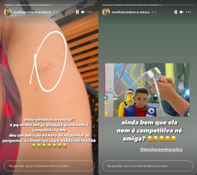 Marília Mendonça mostra hematoma causado por Maiara, da dupla com Maraisa (Reprodução/Instagram)