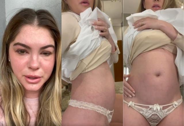 Bárbara Evans mostra inchaço no corpo e no rosto