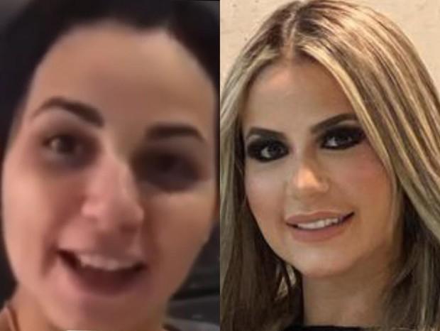 Montagem com Deolane Bezerra antes e depois.