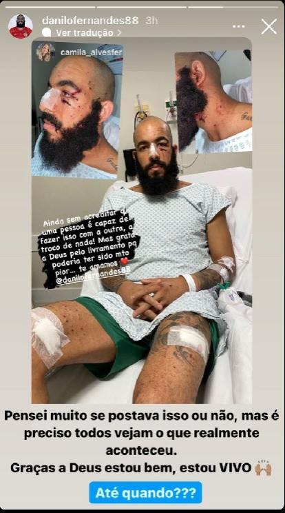 Imagens do goleiro Danilo Fernandes machucado no hospital