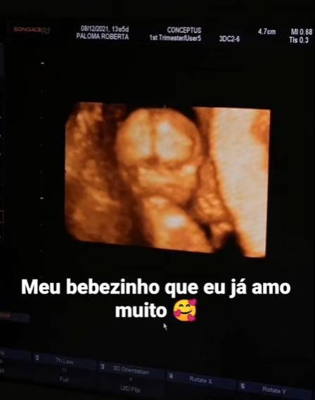 Foto que mostra o ultrassom do bebê.