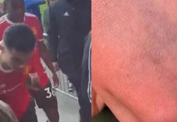 Mãe de torcedor do Everton acusa Cristiano Ronaldo de agressão