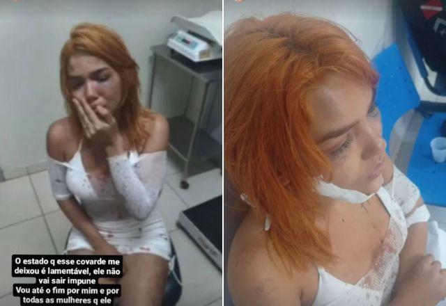 Mel Dantas expôs as agressões que sofreu do funkeiro | Reprodução/Instagram