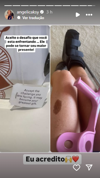 Angélica nos stories mostrando bota ortopédica.