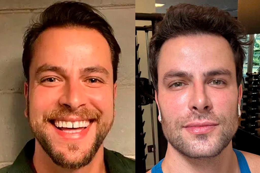 Antes e depois Gustavo Marsengo.
