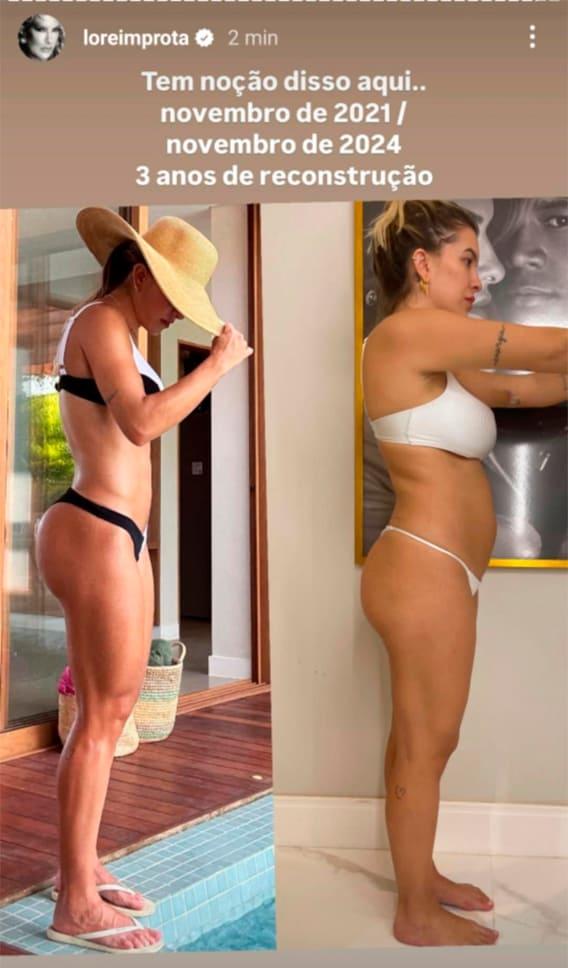 print dos stories de antes e depois de Lore