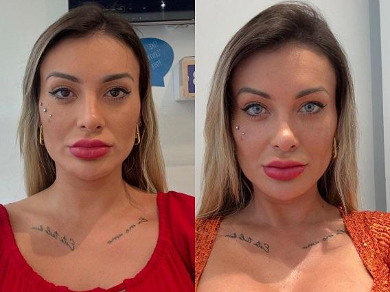 Antes e depois da cor dos olhos de Andressa Urach