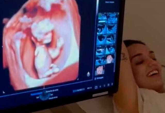 Rafa Kalimann mostra ultrassom