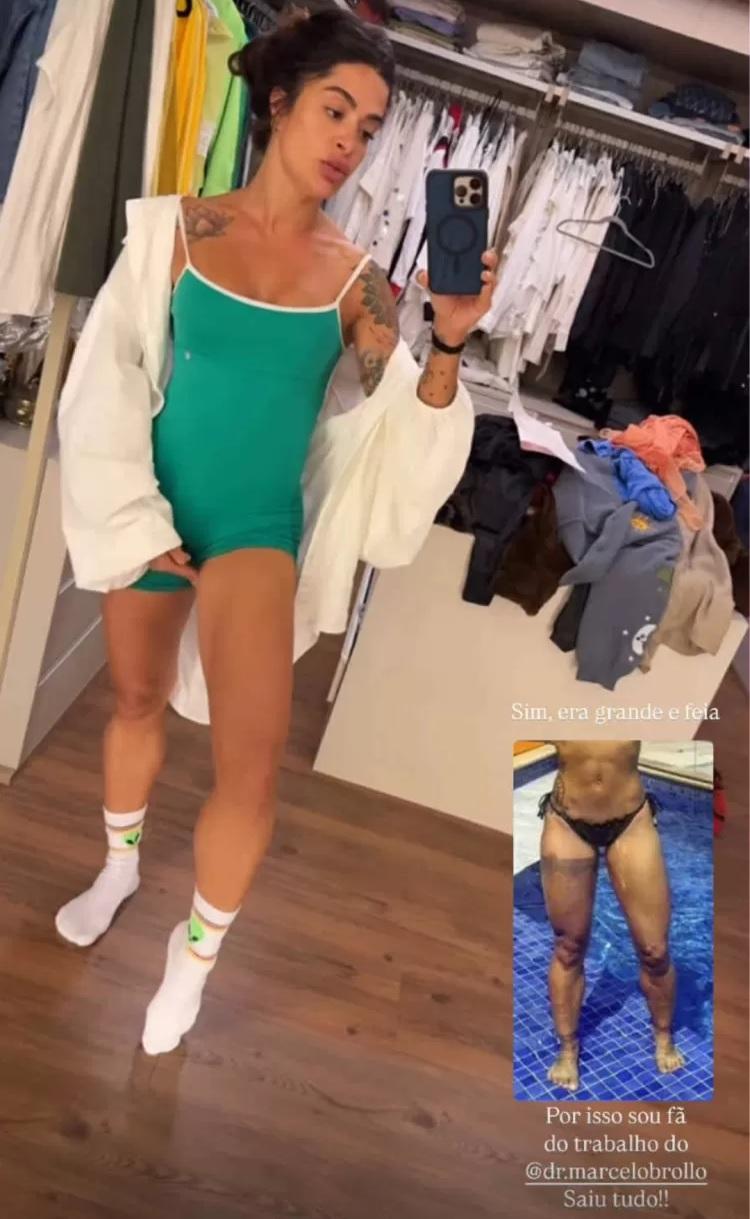 Aline Campos mostra antes e depois da tatuagem