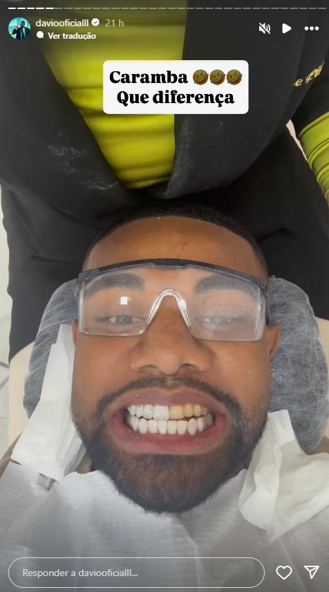 Davi Brito troca lentes de contato.