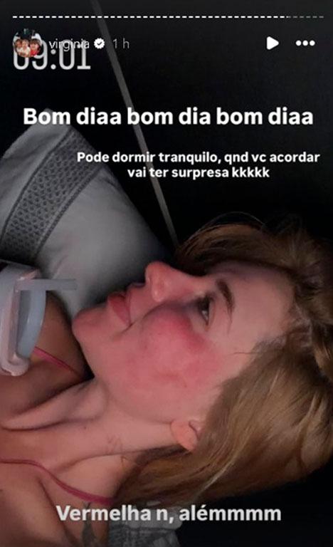 virignia mostra rosto vermelho nos stories
