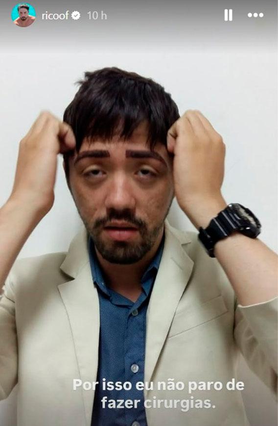 rico melquiades publica foto do rosto antes de cirurgias